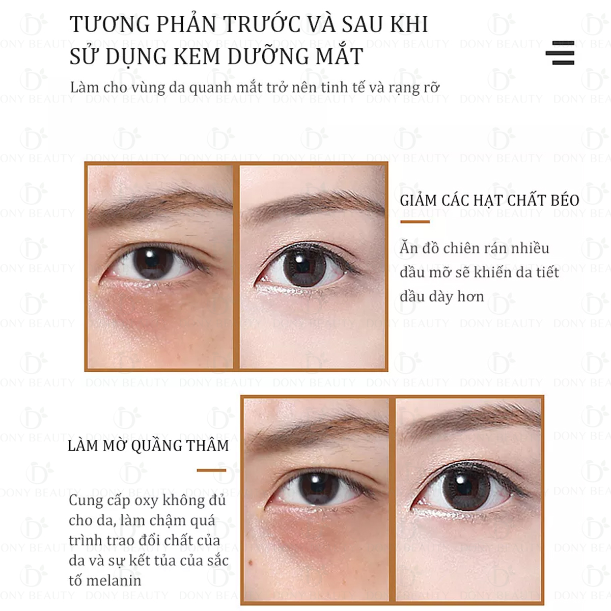 trước và sau khi dùng kem dưỡng trị thâm quầng mắt Premium Placenta White Label Eye Cream