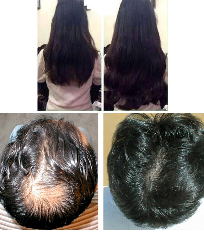 Viên uống chống rụng tóc, mọc tóc Biotin 10.000mcg Natrol mua ở đâu?